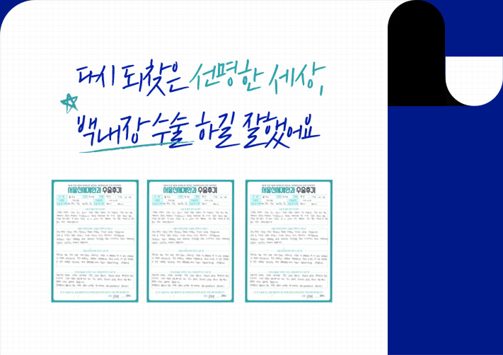 서울신세계안과 수술 후기