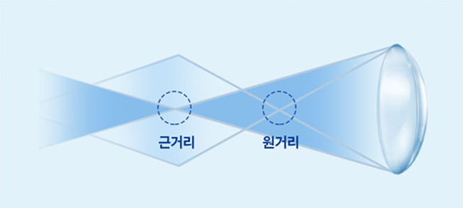다초점 인공수정체의 다중 초점 조절력 