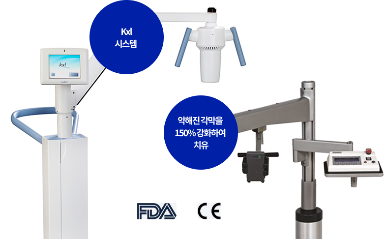 Kxl 시스템, 약해진 각막을 150% 강화하여 치유