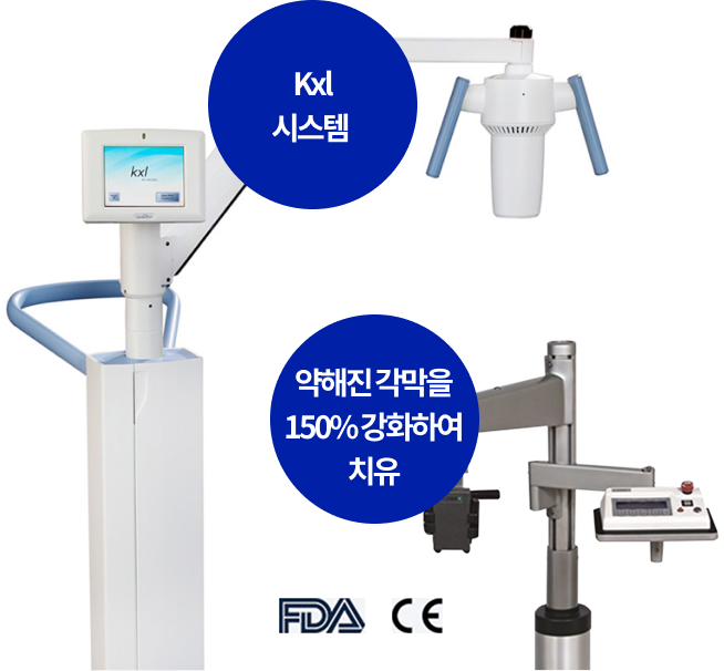 Kxl 시스템, 약해진 각막을 150% 강화하여 치유