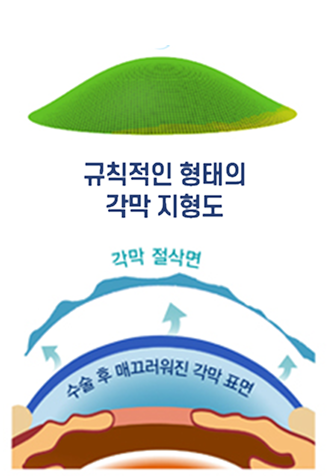 진단