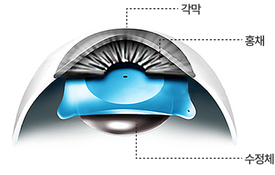 홍채 뒤, 후방렌즈 삽